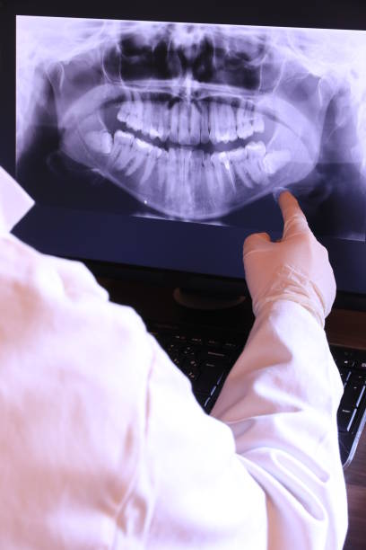 Best Knocked-Out Tooth (Avulsed Tooth) Treatment in Munster, IN