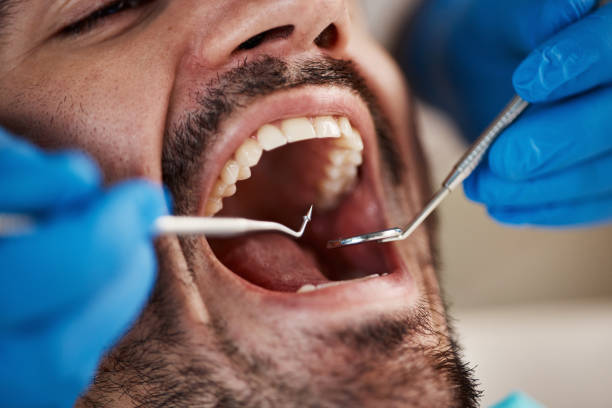 Best Broken or Chipped Tooth Repair in Munster, IN